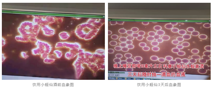 水蛭素、小蛭仙酒、醬香水蛭酒