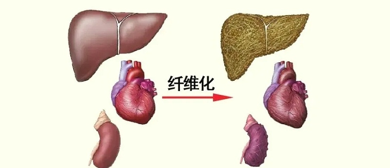 水蛭素、活血化瘀、纖維化