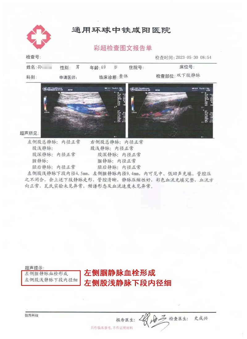 水蛭素、水蛭素膠囊、壯醫(yī)水蛭療法