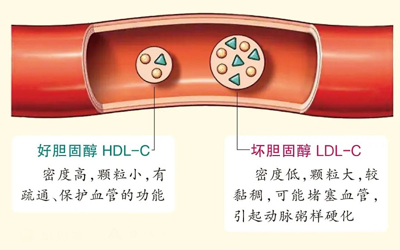 水蛭素、膽固醇、壯醫(yī)水蛭療法培訓(xùn)