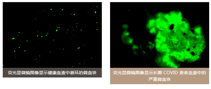 水蛭素、老年癡呆、前列腺、陽(yáng)康