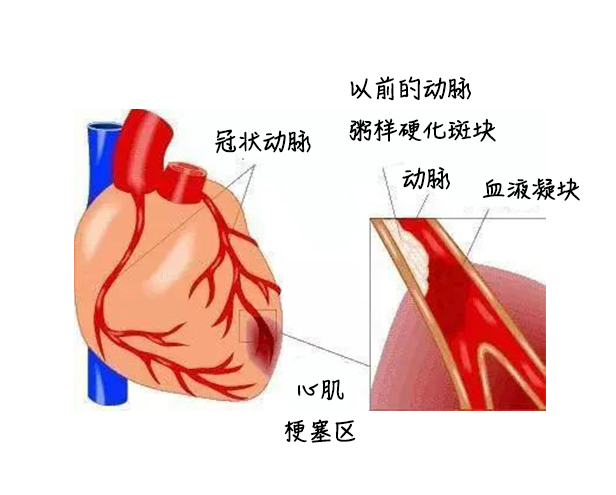 中醫(yī)藥健康旅游、心梗、面癱