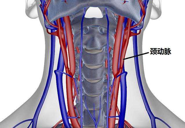 頸動(dòng)脈斑塊的產(chǎn)生以及預(yù)防
