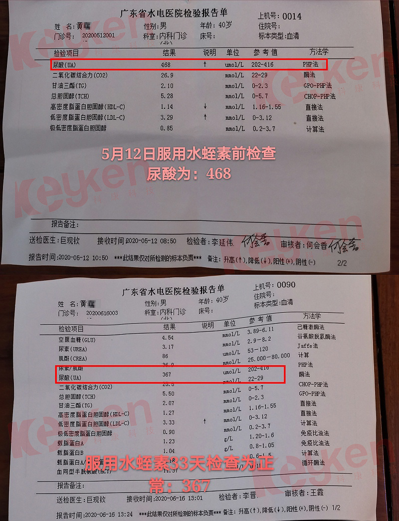 水蛭素、尿酸、痛風(fēng)