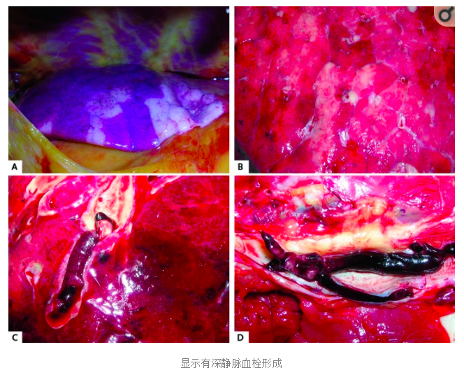 水蛭素、陽康、烏梅、壯醫(yī)水蛭療法