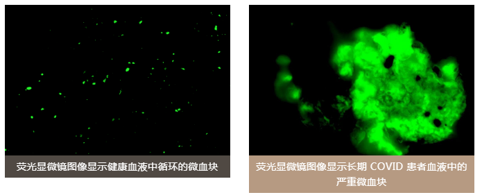 水蛭素、陽康、烏梅、壯醫(yī)水蛭療法