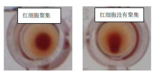 水蛭素、新冠病毒、壯醫(yī)水蛭療法