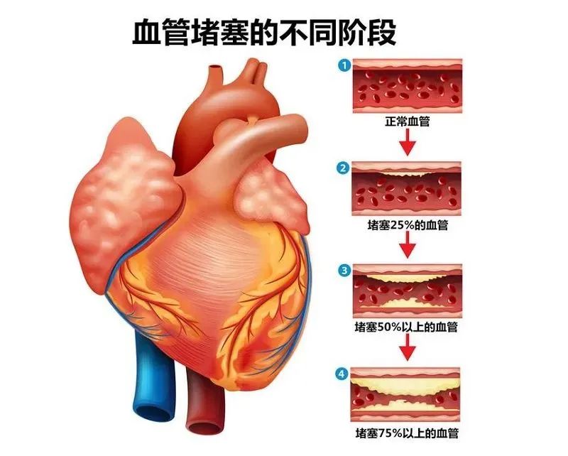 壯醫(yī)水蛭療法，天然水蛭素